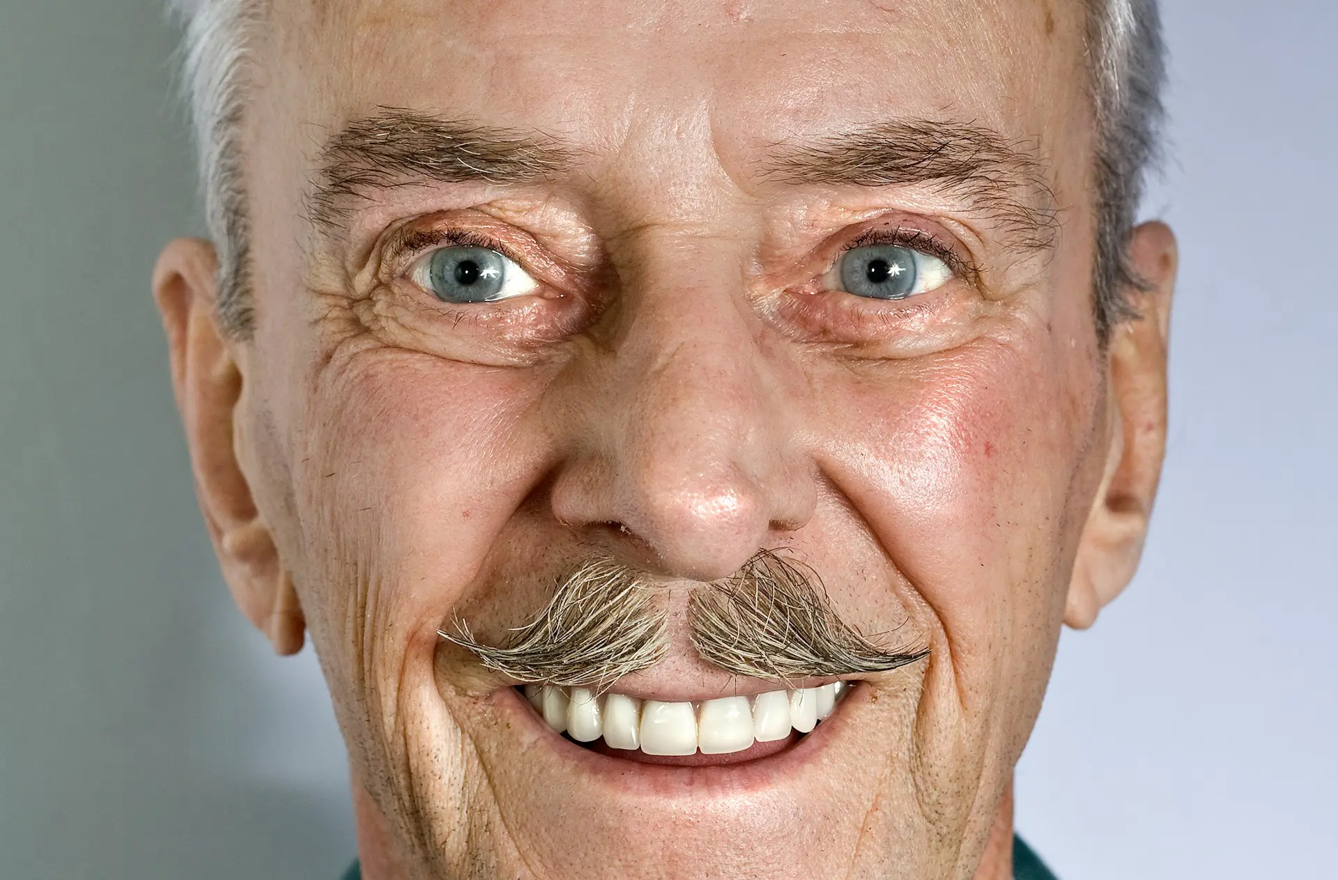 tooth replacement options