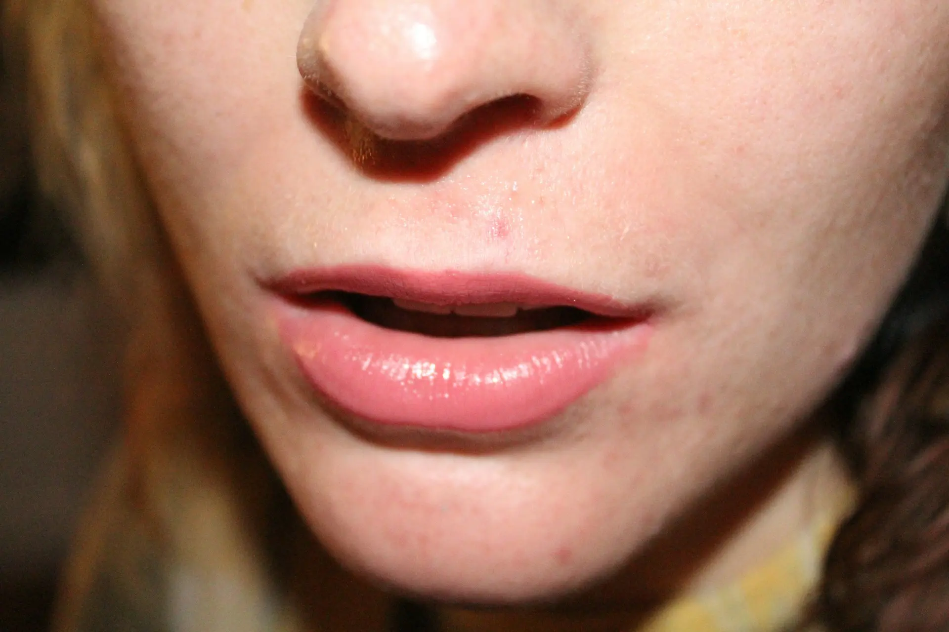 person with mouth open