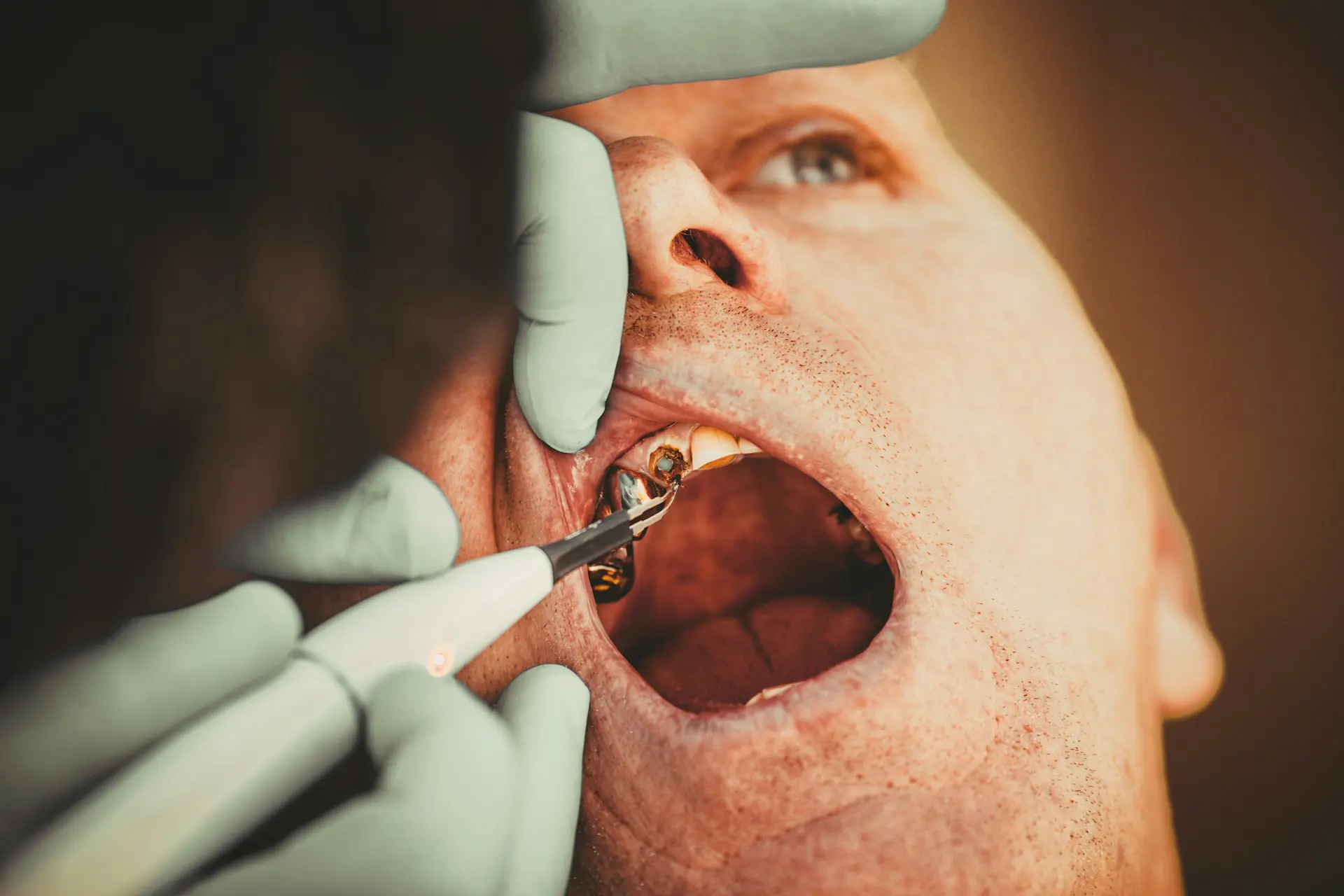man with dental tools in his mouth