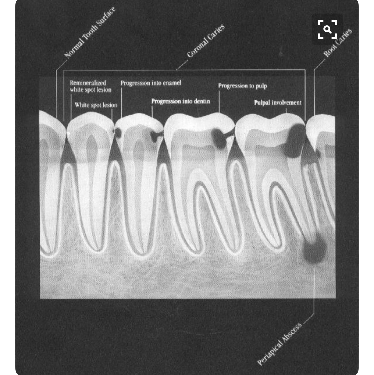 Why Do I Need X-rays? by Your Prescott Dentist Hicks Dental Group