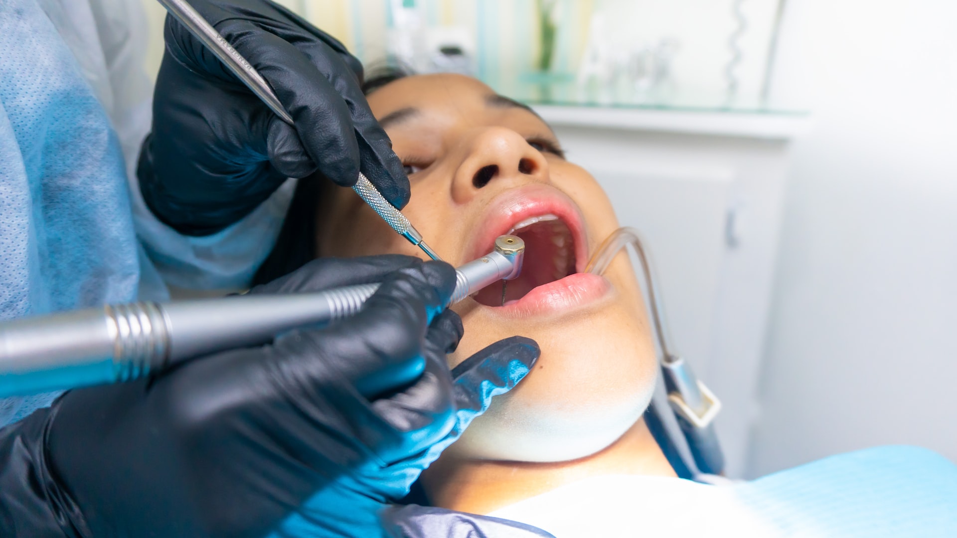 woman in the dentist's chair with a dentist working on her mouth - what are inlays onlays