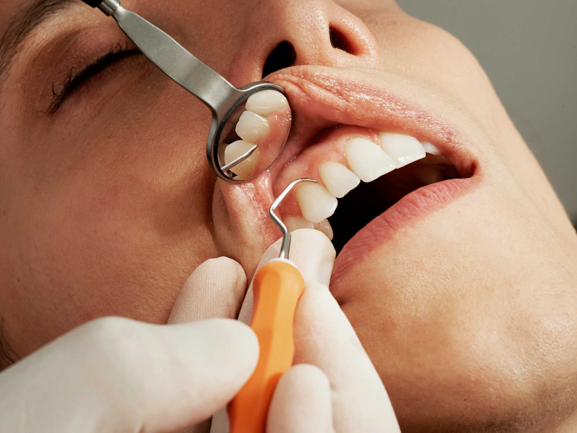 woman getting her teeth scraped - tartar vs. plaque